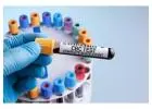 Curious About CBC Test Prices in Delhi? Here’s What You Should Know