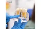 Best Dental Implants Brands in Venezuela for Dentists