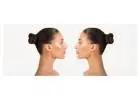 Rhinoplasty Surgery 101: What You Need to Know About Nose Reshaping