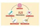 IUI Treatment In Delhi - Dr Rhythm Gupta