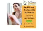 Best Pimple Treatment In Hyderabad | Dr. Venus