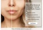 Buccal Fat Removal in Ontario | Nichols Facial Plastic Surgery