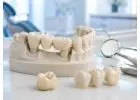 Durable Dental Crowns and Bridges for Missing or Damaged Teeth