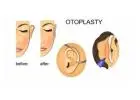 Ear Reshaping Surgery in Delhi - Dr Rajat Gupta