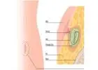 Advanced Care Solutions for Piles and Anorectal Health Issues
