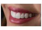 Porcelain Veneers in Abbotsford | Transform Your Smile