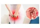 Ayurvedic Care for Piles and Fistula with Expert Guidance