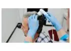 Effective GFC Treatment for Hair Growth at Dermaprocenter